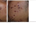 4th day after IPL