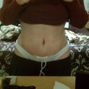 Front view 2 wks po