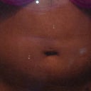 Stomach 1 day after surgery