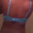 Back Day 4 post op