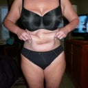 My tummy rug/carpet....whichever, it has to go!   Large freckle by my left hand is now on my cut line!!!