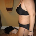 One week post op