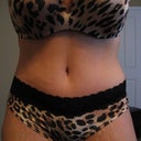 4 weeks post procedure