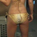 Before zeltiq: Month before breast revision and was working out a lot since I knew I would have a few wks of down time but still have pockets of stubborn fat.