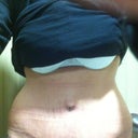 2.5 weeks scar