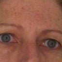 It's been 6 weeks and not much of anything.  I hope the next 1 1/2 months I can see a difference.
