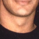 Before. Same body weight. Pointed. Long. Upturned. Protruding chin.