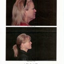 These photos where taken after 5 weeks, I look and feel great!