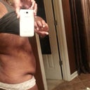 Before (right side) tummy flap and no butt do to 148lb weight loss over the years!