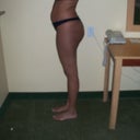 The morning of my surgery "before picture"