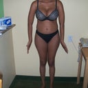 The morning before surgery