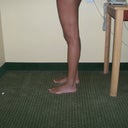 Before surgery