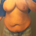 Front w/ Boobs Before