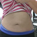 this belly button has to go. never was like that until my first lipo...once all the fat is off i'm definitely going to stuff it with cotton this time to make it round again