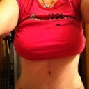 8 weeks post op front view