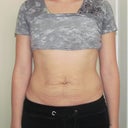 With me tightening my muscles. My stomach appears more wrinkled in person.