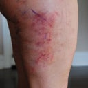 close up right lateral