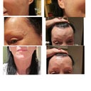 Shows all the horrible things, brow, ears, cheeks