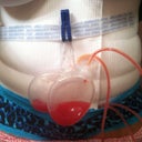 Compression Garment and drains!  Ever so lovely!