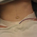 1 day Post-Op