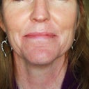before picture...age 48