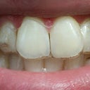 Tray 4