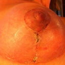 And more healing.... The dark spots that look like scabs are actually the glue.