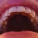 Top teeth - I see no improvement from the first shot I uploaded like this.