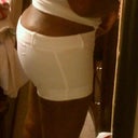 I don't have any before pics but this is about 8 days post.