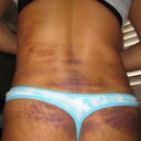 Rear 2 weeks post