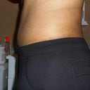 Side view Day 8 with same pants on as before... still swollen
