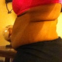 Side view-before surgery