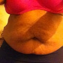 the belly-before surgery... YUK