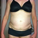 Night before surgery