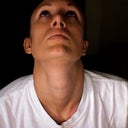3 months post op- nostrils seem to be evening up a bit.
