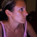 side view of less swollen side