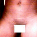 this was the natural shape of my stomach