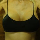 Two weeks post-op.  This is the most comfortable bralet by Forever 21.  Under $5.00 and no binding band.  Super comfy and has removable pads for extra coverage and support.