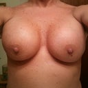 12-19-2012 I'm just 3 days shy of 8 weeks Post. I love them as you can see from all my pics they look better and better and they change from day to day, it's funny not knowing what your going to wake up with each day. It's so worth it why worry, right! All the strapless cotton cami's I found on line thru e-bay. or in the summer "Walmart" that's where I purchased mine, but ebay has a lot and nice colors this is the way to go ladies for two months at work.
Who can take pic's of themselves that look nice? Not me.