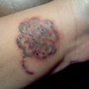 Treatment 2, nine hours post 
You can kind of see by the indentation in my skin on the bottom of my wrist how swollen it is.