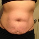 Before front