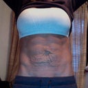 pre surgery