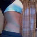 pre surgery