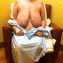 All marked up and ready to go into surgery.