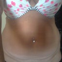 preop front view