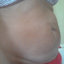 preop side view