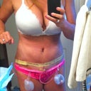 post op day 2