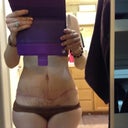 10 weeks nearly. My line is crooked, and so far still have dog ears :-( it dips quite a bit at the spot that I always seemed to have a pudge spot, was figuring I was swelling, but has never diminished. Tomorrow is my appt w/ ps, I plan to ask about it.