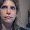 this is me after the 2 vials in March the swelling is from getting my top lip injection.