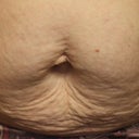 This is what three kids did to my body :(